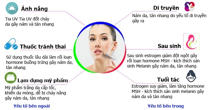 nguyên nhân gây nám da và cách điều trị nám da